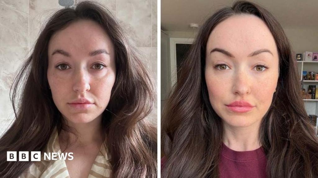 Viral 'Ferritin Face' di TikTok, Dokter Tegaskan Penampilan Tak Cukup untuk Diagnosis