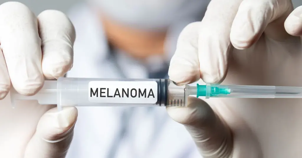 Vaksin mRNA Personal Turunkan Risiko Kekambuhan Melanoma 42 Persen